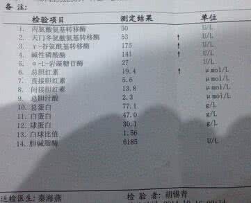 怎么看肝功能是否正常 怎么看肝功能化验单
