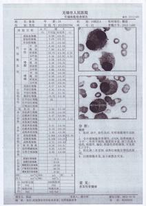 多发性骨髓瘤预防 多发性骨髓瘤的治疗 如何预防多发性骨髓瘤