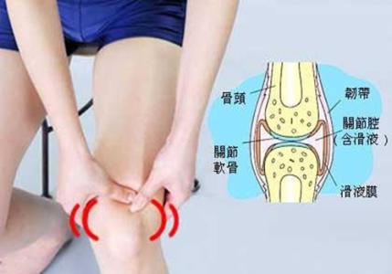 关节炎吃什么保健品 关节炎吃什么好 白领关节保健术