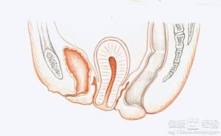 绝经后为什么外阴萎缩 外阴萎缩 为什么会患上外阴萎缩