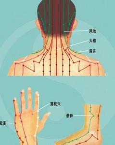 落枕的穴位疗法