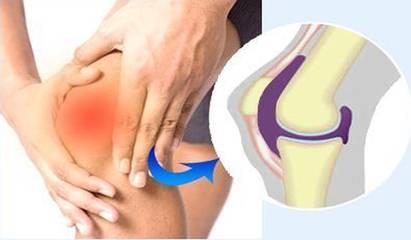 右腿膝关节内侧疼痛 膝关节疼痛，为什么治腿效果不明显，病因可能在另一个部位