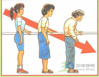 骨质疏松症 骨质疏松症成女人的典型保健盲点