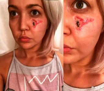 皮肤不好都是自己作出来的!几个会毁容的坏习惯