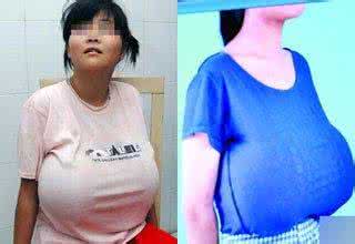 乳房发育一般几岁开始? 女孩胸部多大开始发育