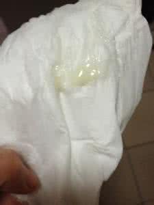 月经前白带多正常吗 月经前白带多正常吗 白带不正常月经不来的原因