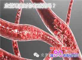 清理软化血管的食物 11种血管清道夫帮助清理软化血管