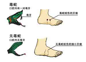 黎族传统纺染织绣技艺 黎族医生是怎样用传统方法处理毒蛇咬伤的