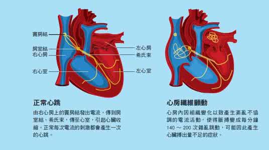 房颤并血栓 房颤 血栓 关注房颤防范血栓