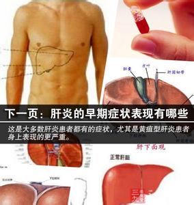 肝炎的早期症状 肝炎的早期症状 千万别小瞧这几种症状