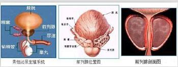 导致男性尿道炎原因 尿道灼热原因 尿道灼热 什么原因导致它的发生