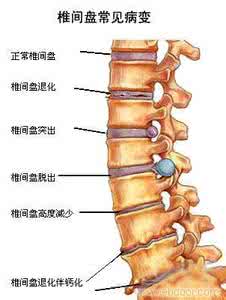 骨关节病中医保健 骨关节病 中医怎么治疗骨关节病