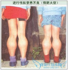 察世俗每月统记传 孕前慎察：4种传男不传女的遗传病