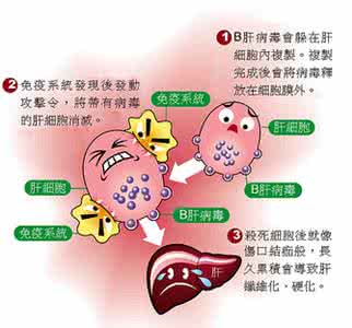 乙型肝炎的治疗方法 肝炎治疗最佳方法 肝炎的最佳治疗方法 吃这物就能治疗