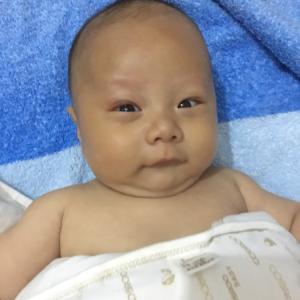 新生儿皮肤发黄 新生儿皮肤发黄是为什么