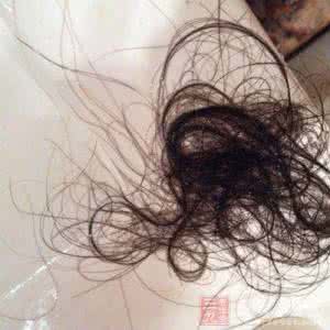 突然头晕是怎么回事 突然头晕是怎么回事 小小头晕千万别忽视