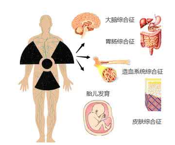 放射性皮肤疾病 放射性皮肤疾病的治疗