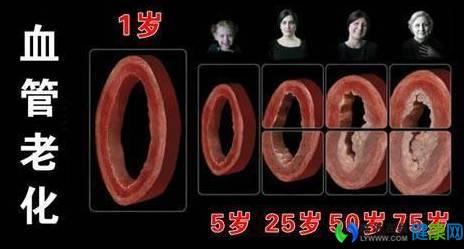 血管堵塞吃什么保健品 随时随地的血管保健术 血管堵了，随时会要命！拯救血管的秘密，都在这里，快看~