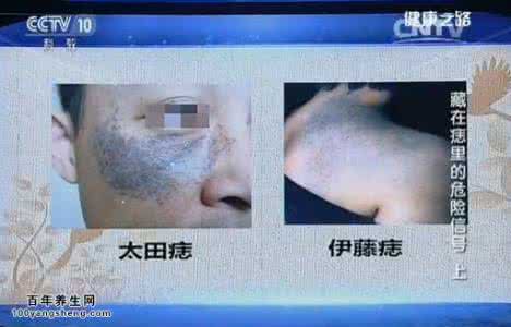 健康之路气滞血瘀 健康之路20151012视频和笔记:贾立群,气滞血瘀,甲状腺癌,乳腺癌