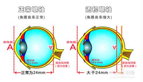 健康之路 近视眼 【健康体操】一张图推荐治疗近视眼《原创晶体操、近视从600度降到0度！》