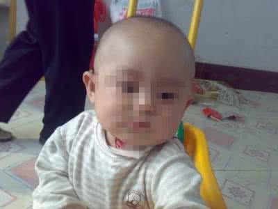 脑瘫儿的症状 脑瘫儿的症状 脑瘫的保健