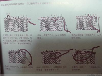 双螺纹手缝针收针方法 名种缝针收针、缝合法