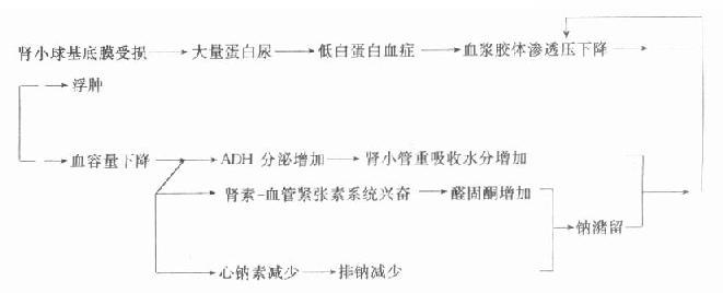 肾病综合征水肿治疗 讲个肾病综合征高度水肿案