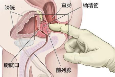 暖通动力技术措施2009 保持强悍房事动力的“八改”措施：第一改：速度