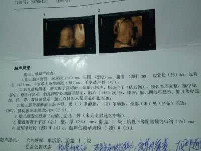 知网本科生论文数据库 我们了解吗:看B超单数据知生男女靠谱吗?