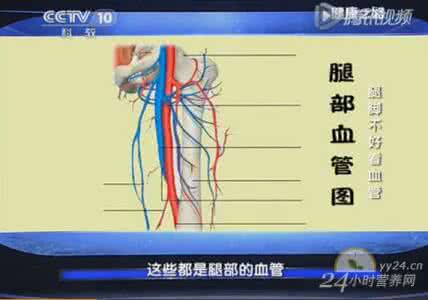 健康之路血管通腿脚轻 健康之路 20150421 腿脚不好看血管