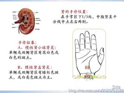 冬季保健知识 手诊保健知识——13、肾炎*