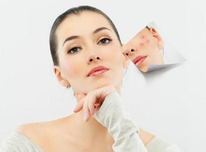 色斑 淡斑前先了解自身是哪类色斑