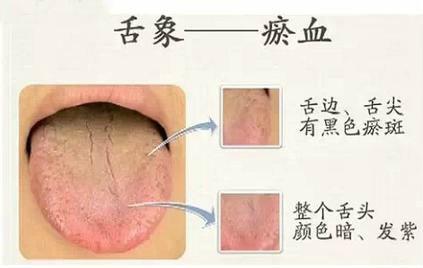 放大镜 管住你的舌头很重要，是人体健康的放大镜！