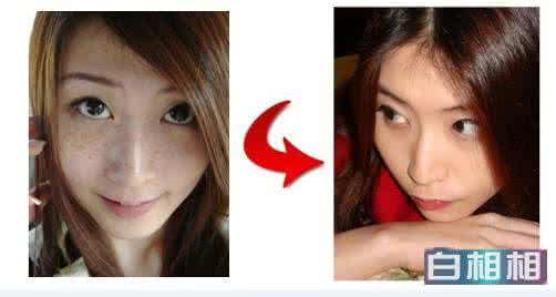 祛斑的治疗方法有哪些 治祛斑的方法有哪些？