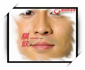 人中有横纹是什么病 人中有横纹代表什么？