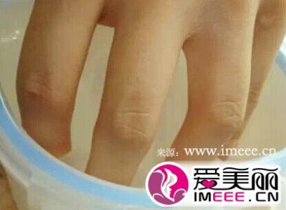 指甲油怎么洗掉小窍门 指甲油怎么洗掉小窍门 洗衣小窍门合集，不管染上什么都能洗掉！