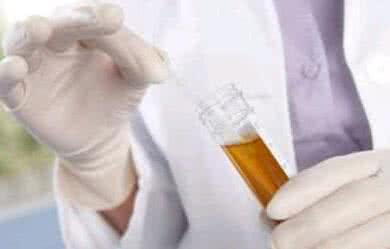 脚是身体的晴雨表 尿色是健康晴雨表 七种尿色看身体病兆