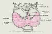 急性甲状腺炎能自愈吗 急性化脓性甲状腺炎