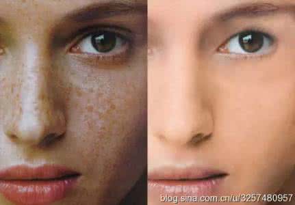 如何用蜂蜜去斑 姜加蜂蜜能去斑吗?