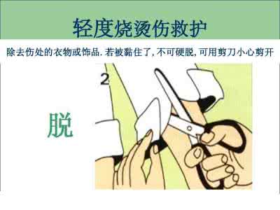 烧烫伤急救最先的要点 烧烫伤急救的对与错