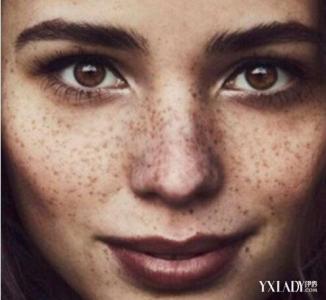 黑色素沉着怎么办 黑色素沉着应该怎么办?