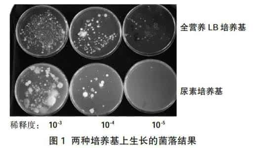 硝化细菌碳源 硝化细菌培养 培养硝化细菌的碳源、氮源和能源的依次是 A.葡萄糖、氨、葡萄糖B.葡萄糖、铵盐、太阳能C.二氧化碳