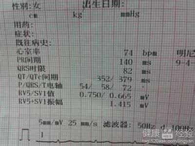 心律不齐是心脏病吗 心律不齐的症状