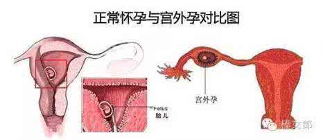 怎么防备勒索病毒 大姨妈怎么防备？