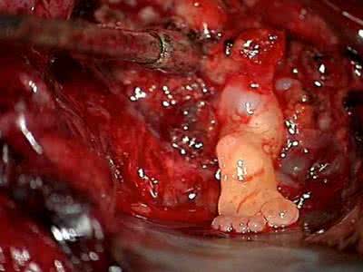 头部受到撞击后危险期 不可思议的奇迹 不可思议！孕妇受到重大撞击后，竟然见证了奇迹！