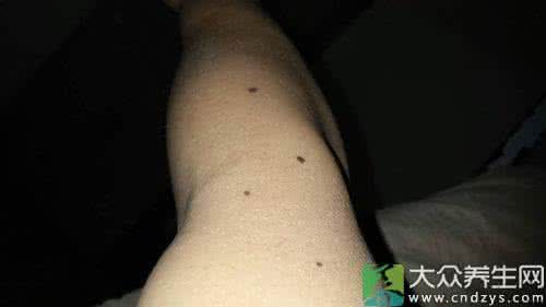 身上这处疼痛竟是癌症 癌症滋生竟是从这个地方开始