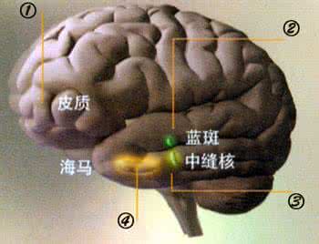 大脑萎缩严重吗 弥漫性大脑萎缩