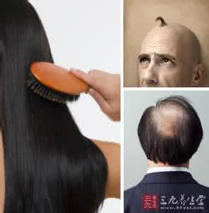中医治疗脂溢性脱发 脱发怎么办 中医教你如何赶走烦人的脱发