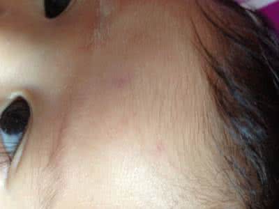 毛巾紫色斑点 洗脸毛巾有紫色斑点 每天用它洗脸,坚持15天斑点全无,皮肤嫩的掐出水