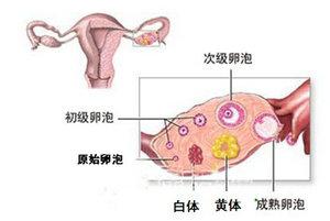 黄体破裂手术要多少钱 黄体破裂做手术多少钱 黄体破裂需要手术吗?